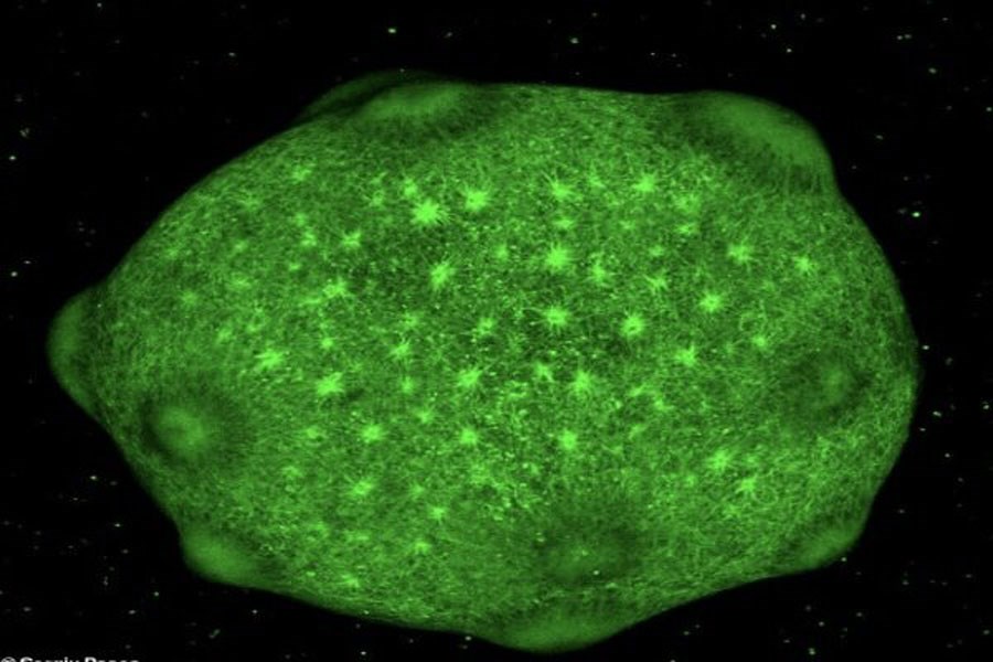 تصویر پرورش مغزهای مینیاتوری که در آزمایشگاه رشد می کنند