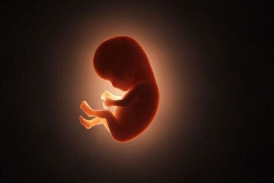 تصویر طرح جوانی جمعیت در مجلس&#47; علت حذف اجبار غربالگری جنین