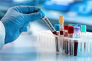 نخستین آزمایشگاه ژنتیک استان مرکزی با هدف ارایه خدمات راه‌اندازی شد