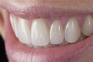 تلاش دانشمندان برای بازسازی دندان‌های از دست رفته