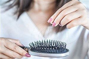 راه های جلوگیری از ریزش مو در دوران یائسگی