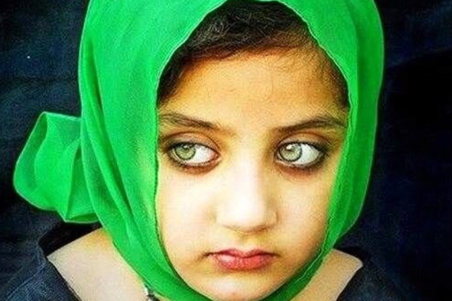 تصویر دختر بچه‌ای که زیباترین چشم‌ های جهان را دارد