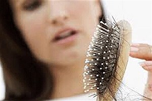 برطرف کردن ریزش مو بدون مراجعه به پزشک