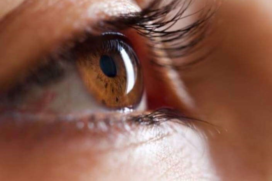تصویر راهکاری برای درمان ورم چشم در خانه