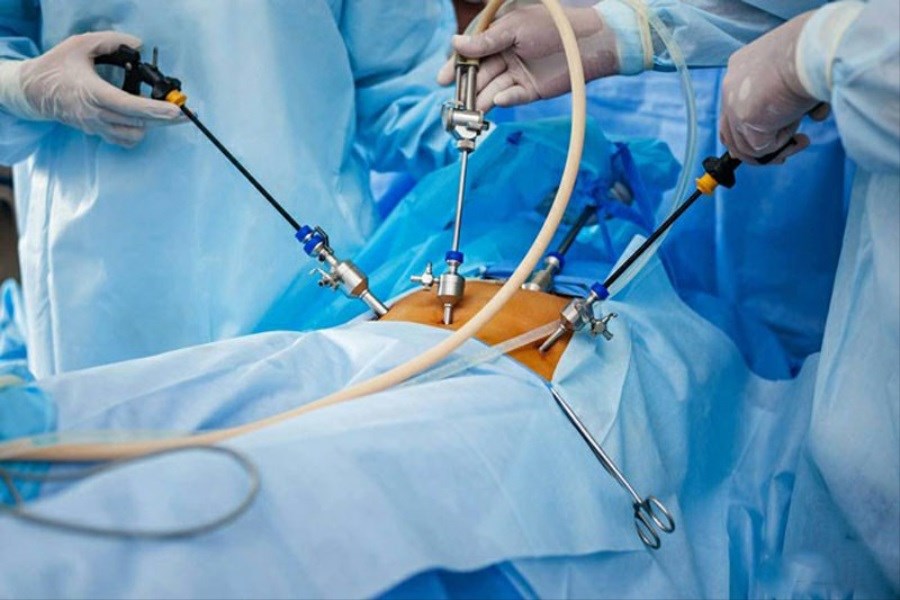 عمل جراحی «لاپاراسکوپی» در کردستان انجام شد