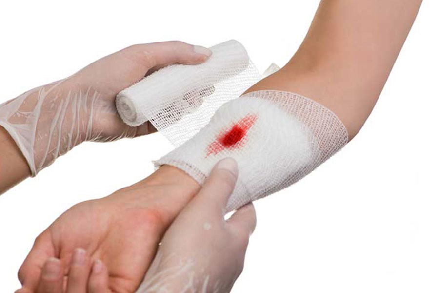 تصویر تشخیص سریع عفونت زخم با کمک حسگر