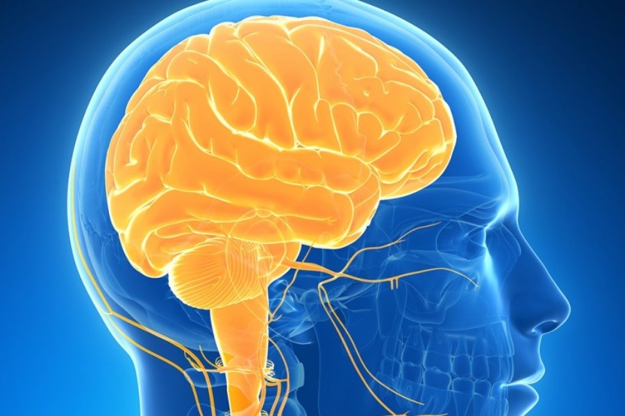 تصویر از بیماری آنسفالیت مغزی چه می دانید؟
