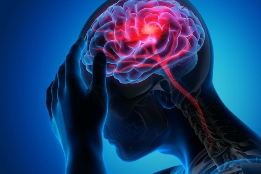 تصویر مصرف چربی خطر سکته مغزی را بالا می‌برد