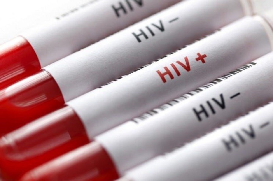 تصویر احیای مجدد برنامه کنترل HIV