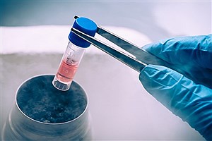 اولین تست روش درمانی ناتوانی جنسی با استفاده از فرآورده‌های سلولهای بنیادی و طب بازساختی