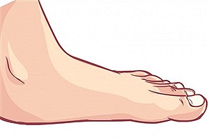 تشخیص سلامت داخلی بدن از روی پاها