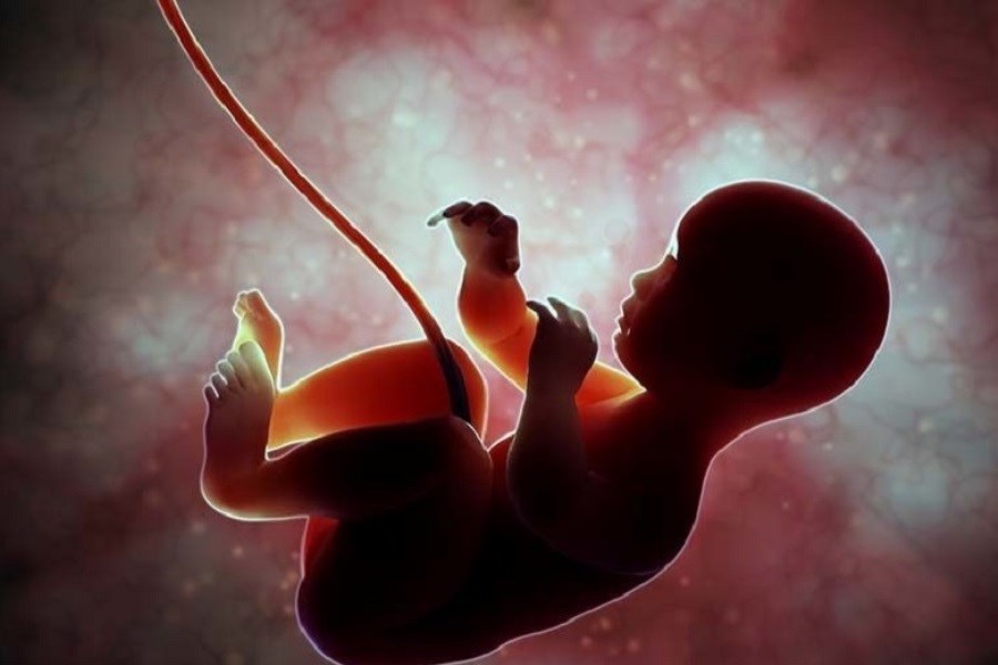 مافیای غربالگری جنین ۱۰۰۰ میلیارد تومان سود به جیب می‌زند