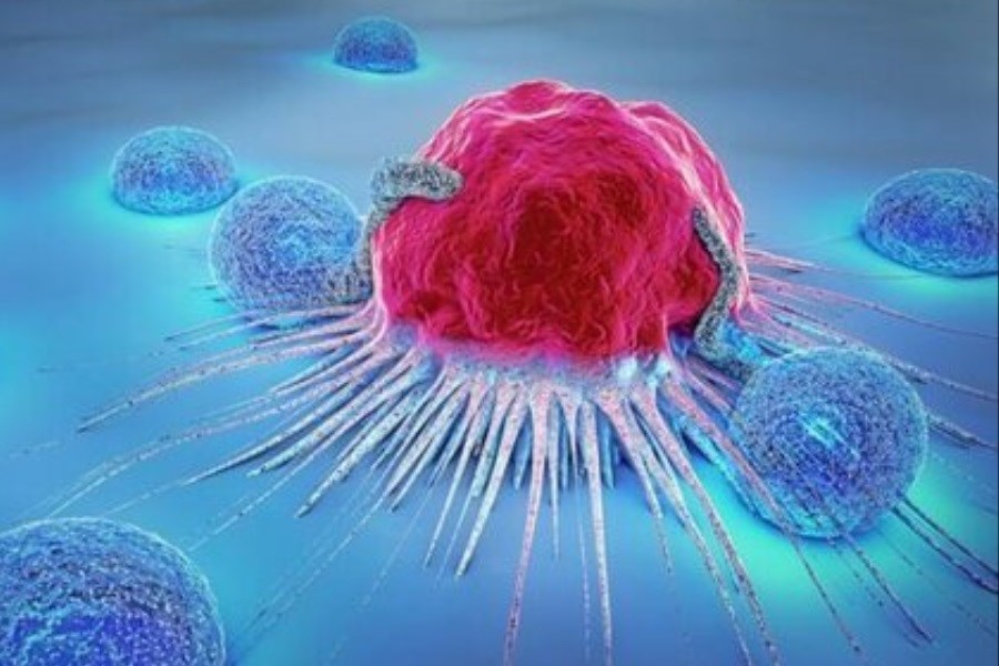 تصویر چند تغییر ساده برای کاهش خطر ابتلا به سرطان