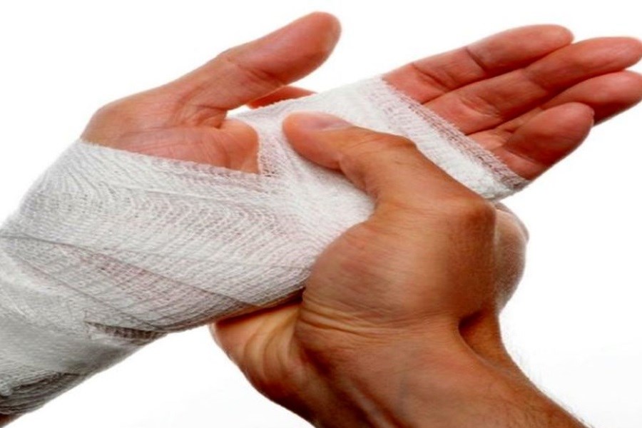 تصویر یک روش ساده برای درمان سوختگی دست