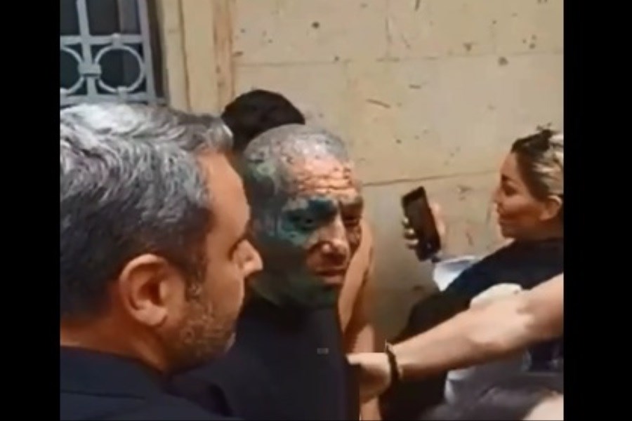 تصویر تتلو در سفارت ایران؛ بخاطر تتو پاسپورت ندادند!.