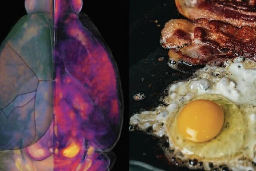 تصویر هشدار&#47; این رژیم غذایی مغز شما را کوچک می‌کند