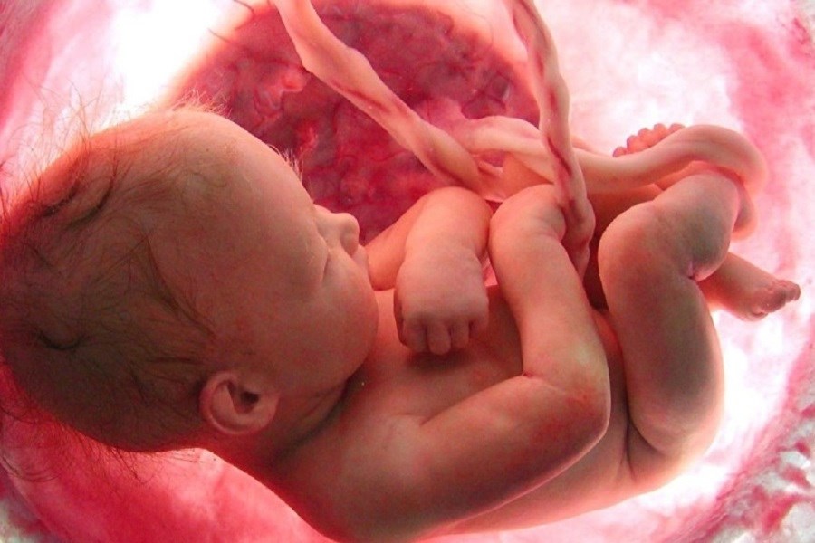 غربالگری جنین با رعایت استانداردها ممنوع نیست