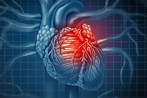دلایل مهم  ابتلا به تومور قلبی&#47; راه‌های درمان آن چیست؟