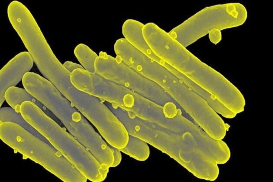 تصویر استفاده از ویروس‌های باکتری‌خوار برای درمان عفونت ریه