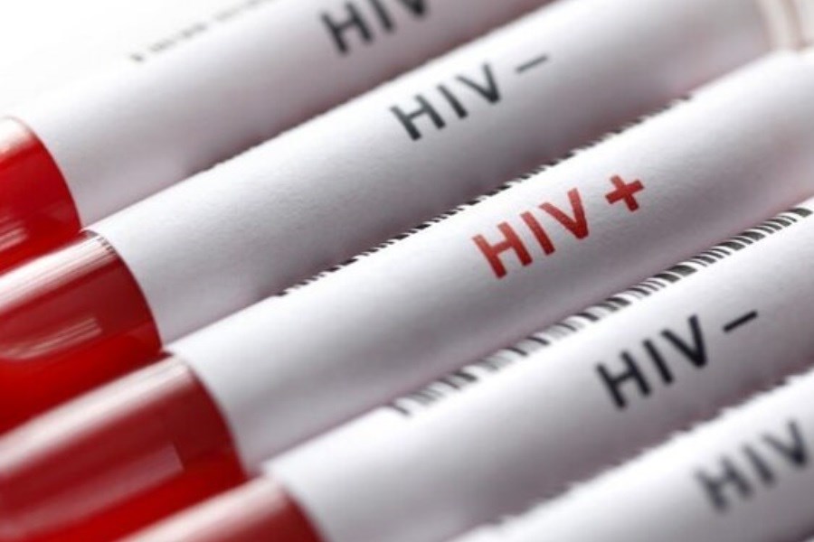 بیشترین علت بروز HIV در ایران چیست؟&#47; چرا آمار زنان مبتلا افزایش یافته؟
