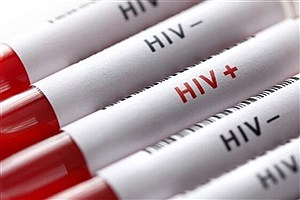 بیشترین علت بروز HIV در ایران چیست؟&#47; چرا آمار زنان مبتلا افزایش یافته؟
