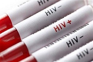 ارائه خدمات بهزیستی به ۵۳ بیمار اچ‌آی‌وی در قزوین