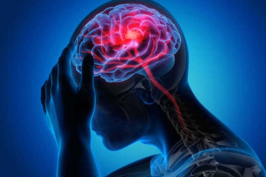 علائم اصلی سکته مغزی چیست؟