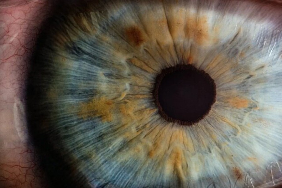 تصویر &quot;اطلس سه‌بعدی چشم&quot;&#47; نخستین اطلس تهیه شده درکشور