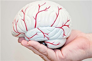 درمان سرطان مغز با روشی جدید