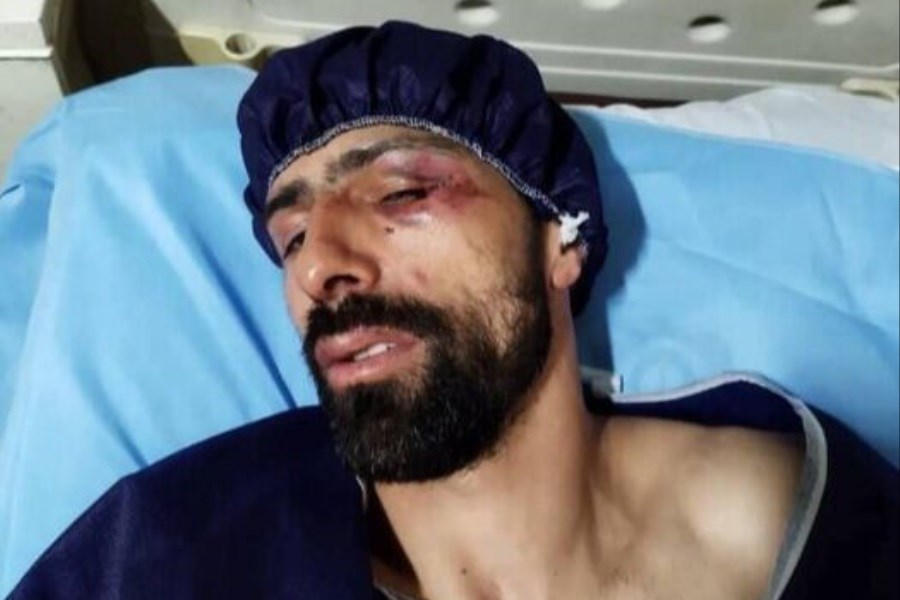 تصویر حمله اراذل و اوباش به بازیکن تیم ملی با چاقو