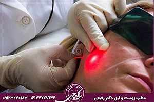 کاربردهای درمان با لیزر