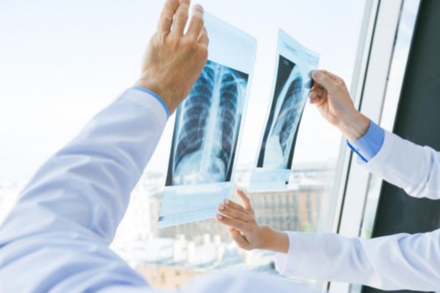 کمبود رادیولوژیست در بسیاری از بیمارستان‌های کشور