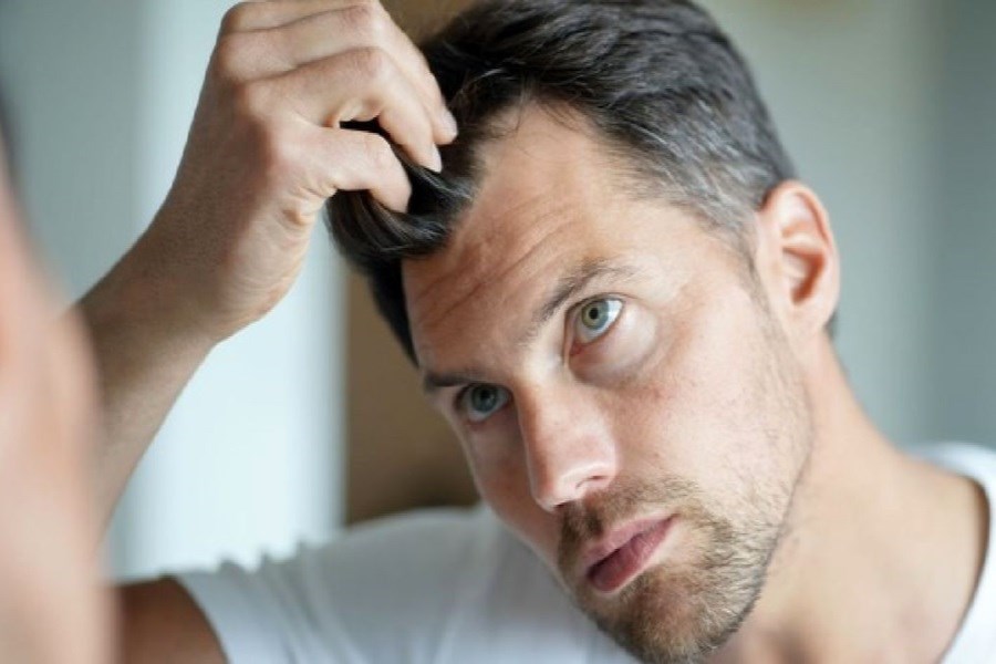 ارتباط هورمونی در موی افراد با بیماری قلبی کشف شد