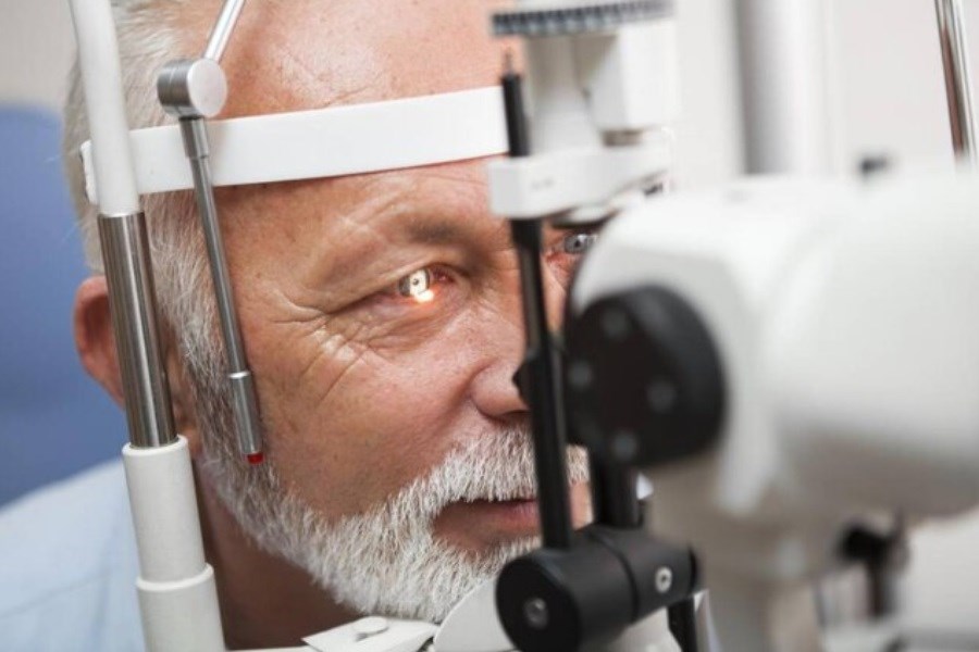 شیوع یک بیماری چشمی بعد از ۵۵ سالگی&#47; سیگاری ها مراقب باشند