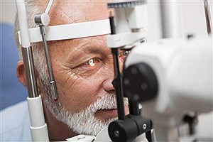 تصویر  شیوع یک بیماری چشمی بعد از ۵۵ سالگی&#47; سیگاری ها مراقب باشند