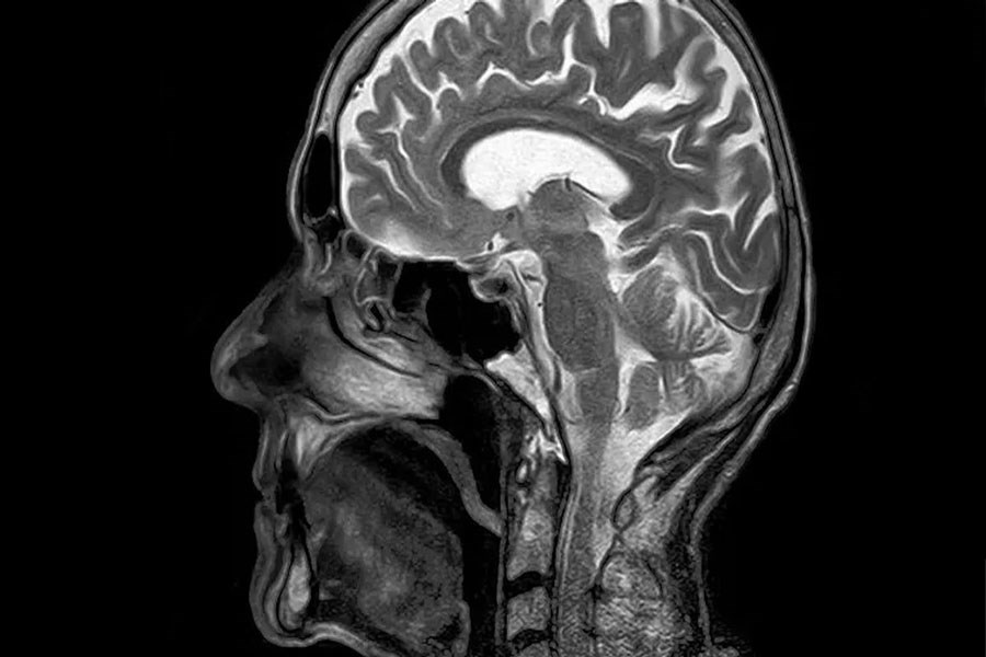تصویر کشف جدید دانشمندان؛ چرا مغز انسان تا این حد بزرگ است؟