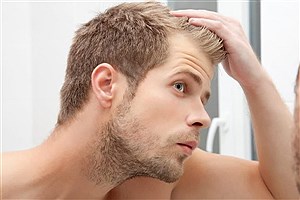 آیا ریزش موی ارثی قابل درمان است؟!