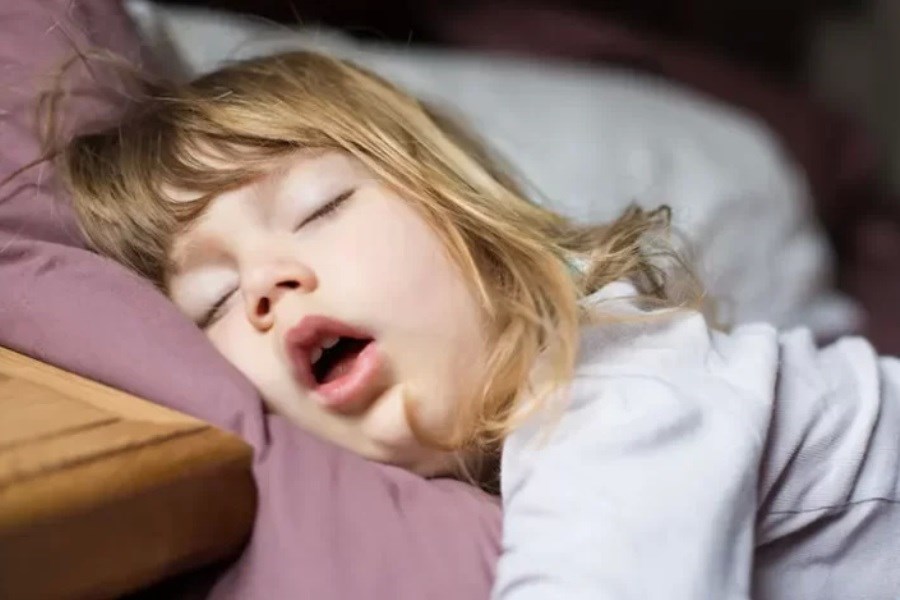 عامل اصلی ابتلا به آپنه خواب در کودکان