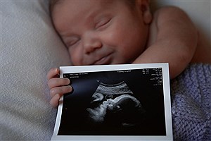 پاسخ به چند شبهه درباره غربالگری جنین