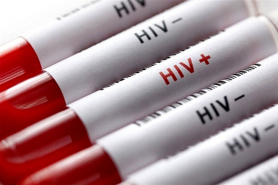 تصویر ۸۱ درصد مبتلایان به HIV مرد هستند