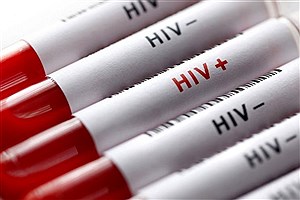 ۸۱ درصد مبتلایان به HIV مرد هستند