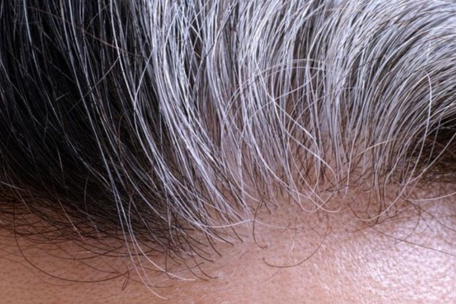 علت واقعی سفید شدن موها چیست؟