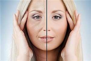 بهترین روش‌های جوانسازی پوست صورت&#47; دلایل بروز چین و چروک پوست