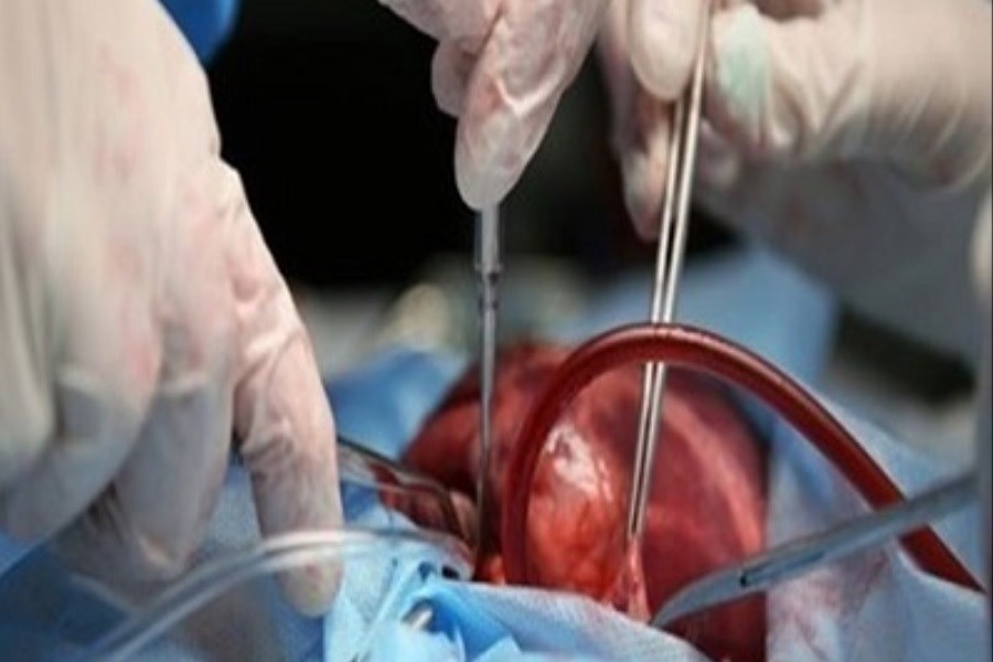 تصویر راه‌اندازی مرکز پیوند مغز استخوان و قلب در همدان