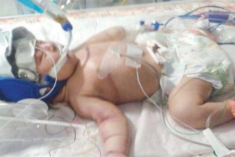 تصویر قصور پزشکی علت فوت نوزاد نهاوندی نبود