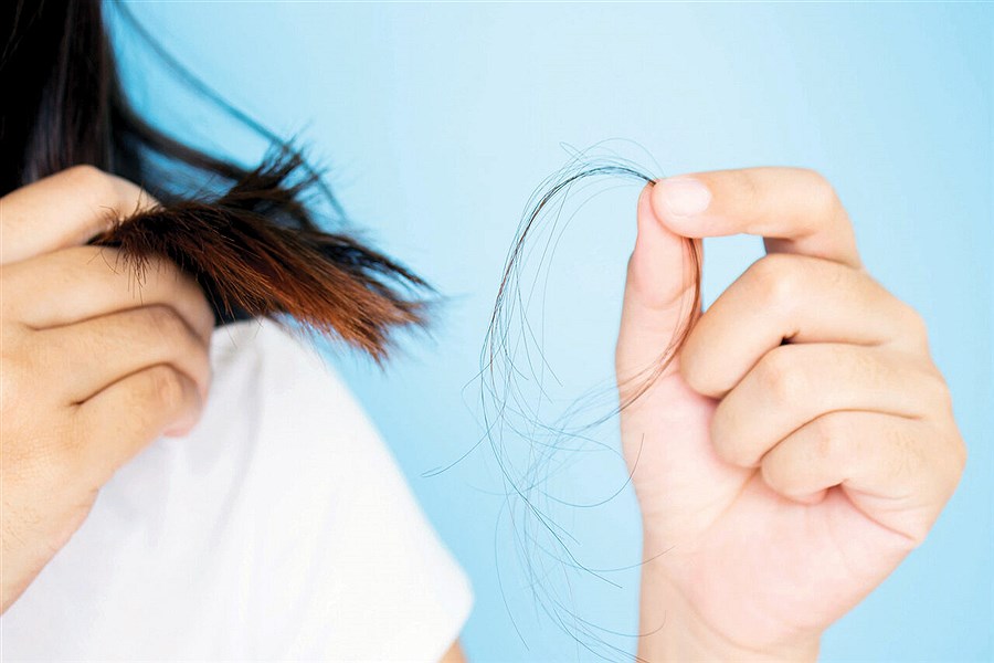 عادت‌های مناسب و تغذیه‌های مفید برای کاهش ریزش مو
