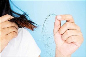 عادت‌های مناسب و تغذیه‌های مفید برای کاهش ریزش مو