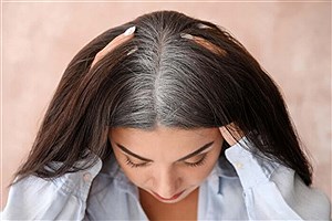 عواملی که باعث سفید شدن مو می‌شوند