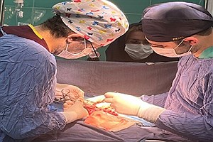نخستین‌عمل جراحی کازایی روی یک نوزاد ۵۰ روزه