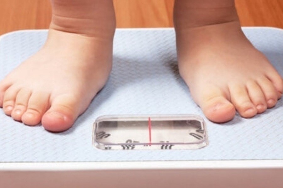 تصویر کمبود این ویتامین باعث چاقی کودکان می شود